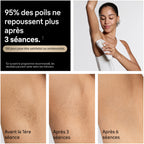 Épilateur à Lumière Pulsée PL5321 Silk·expert Pro 5 240 V 3 Têtes Pochette Rasoir Venus Blanc et Or