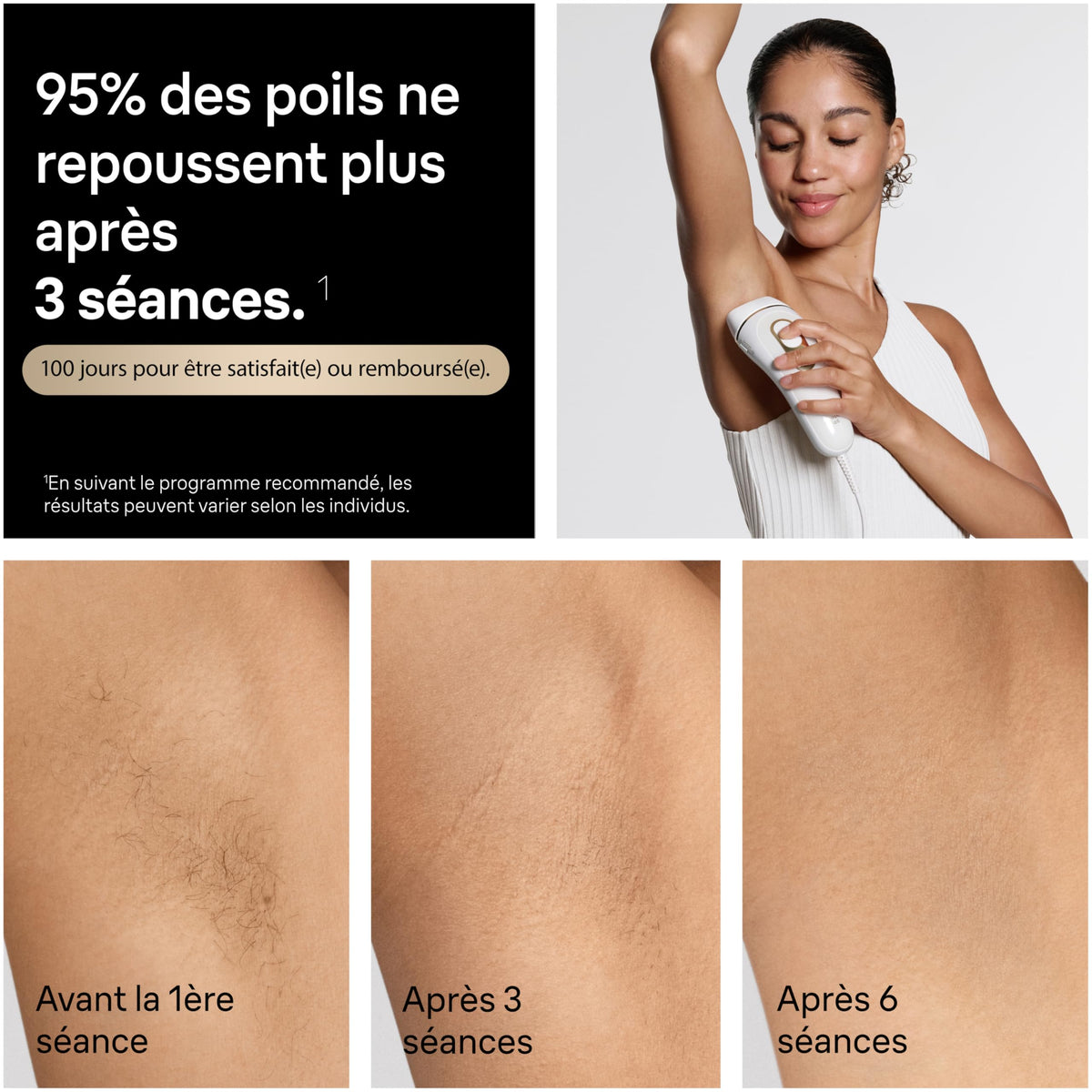 Épilateur à Lumière Pulsée PL5321 Silk·expert Pro 5 240 V 3 Têtes Pochette Rasoir Venus Blanc et Or